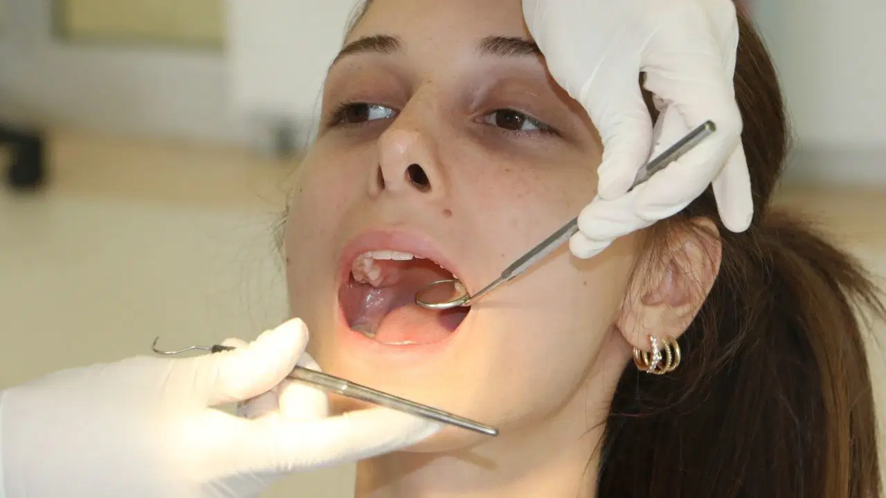 2 haftadan uzun suren agiz yaralari icin dis hekimine basvurulmali Us9BRsg8